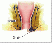11.gif